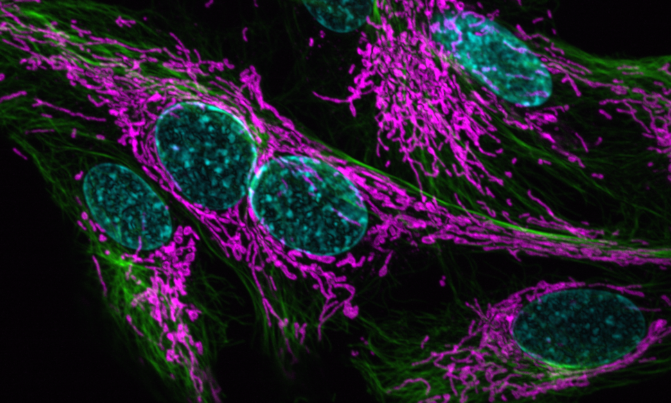 Carlini lab cells