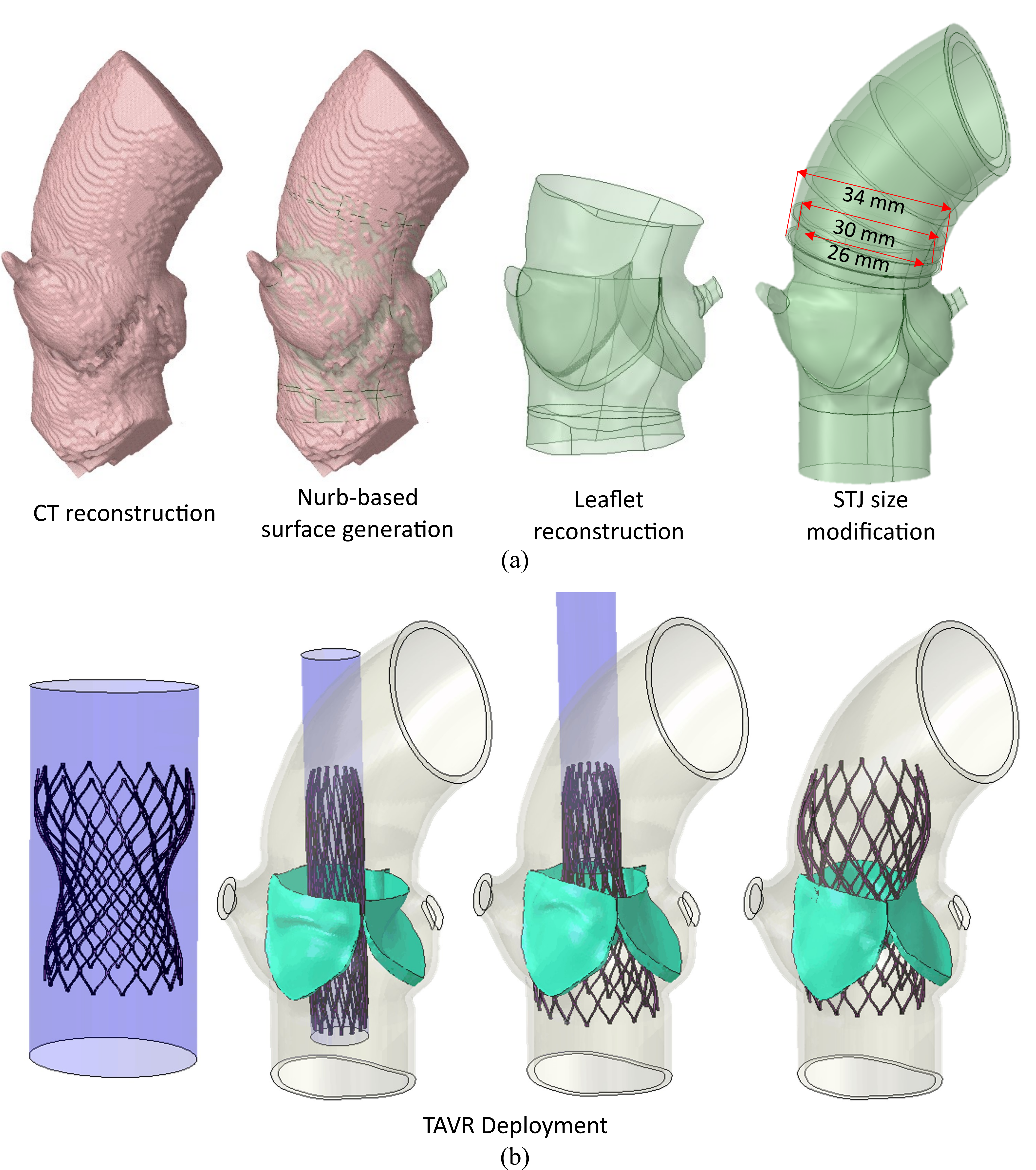 Patient model reconstruction and TAVR deployment